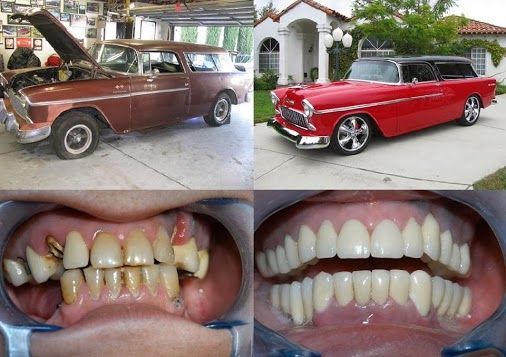 Transform Your Smile with Top Restorative Care in Hyderabad