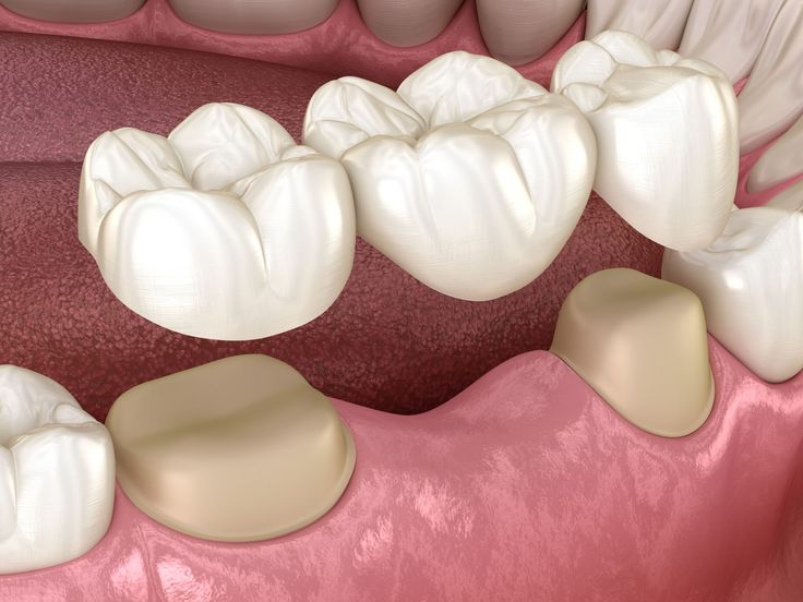 Transform Your Smile with Top Restorative Care in Hyderabad