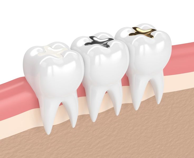 Transform Your Smile with Top Restorative Care in Hyderabad