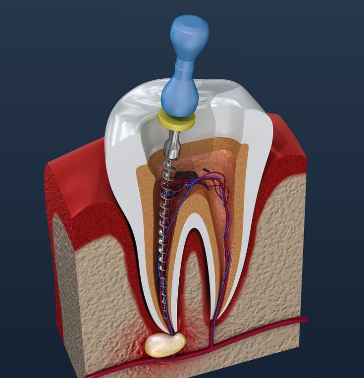 Transform Your Smile with Top Restorative Care in Hyderabad